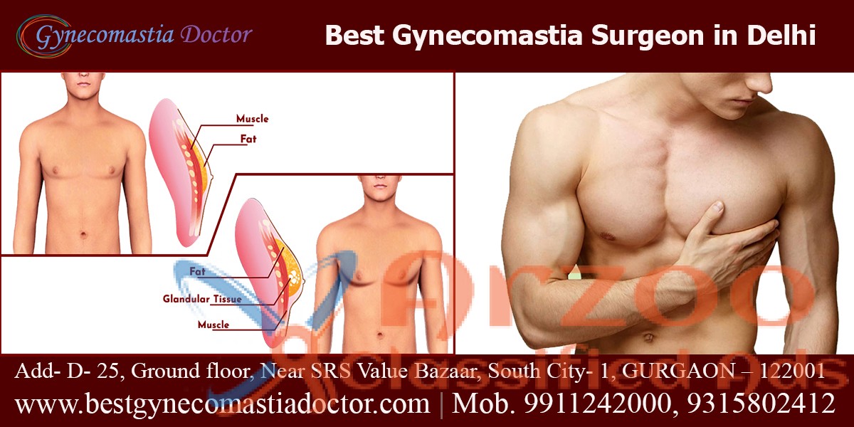 Male Breast Reduction Surgery in East Delhi, India