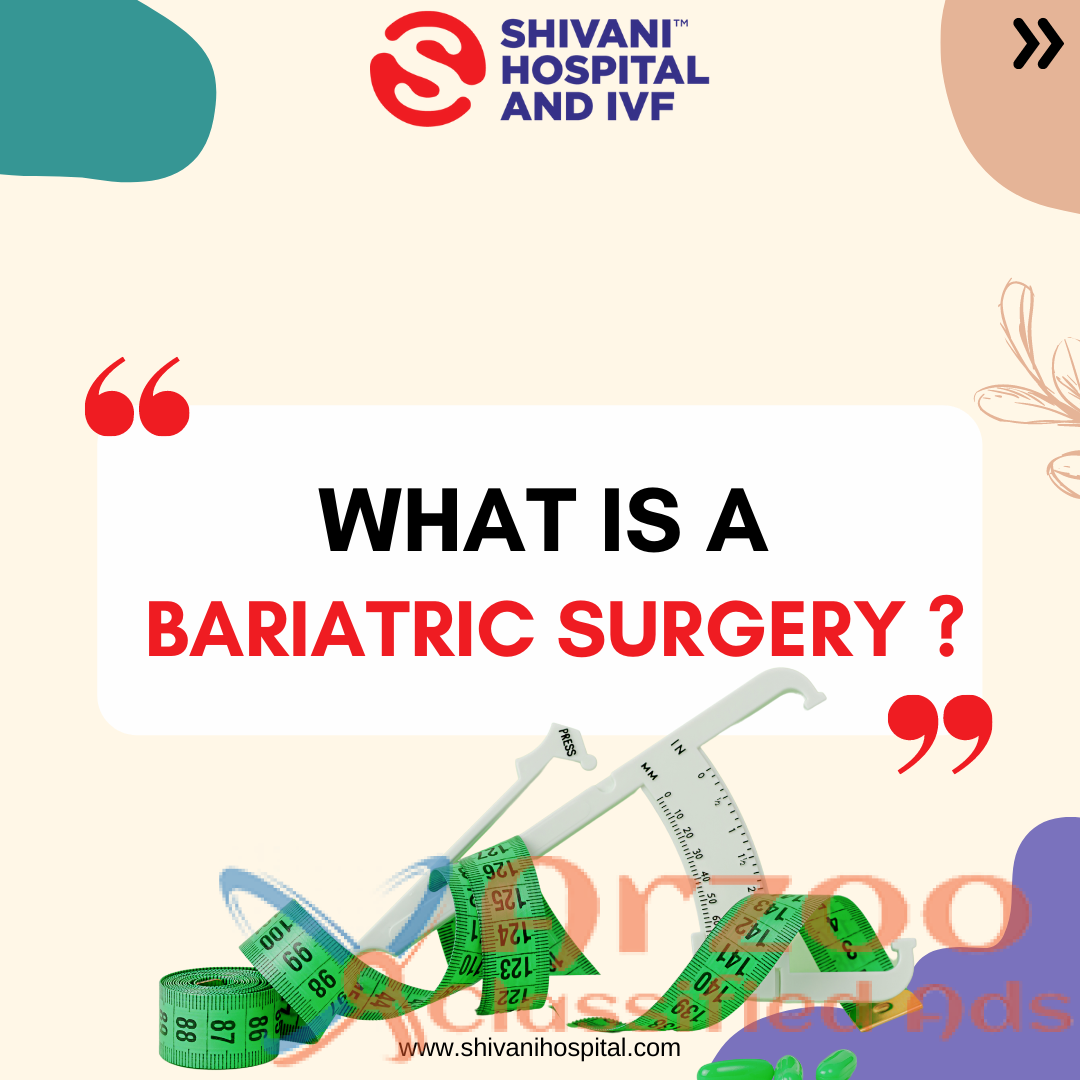 Top Bariatric Surgery in kanpur | Shivani Hospital