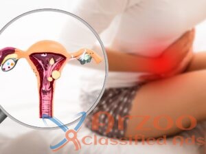 Top Rated Endometriosis Specialist in Ahmedabad