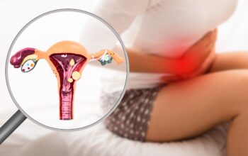 Top Rated Endometriosis Specialist in Ahmedabad