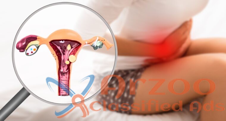 Top Rated Endometriosis Specialist in Ahmedabad