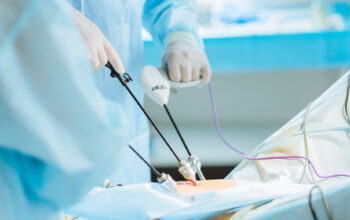 Laparoscopic Surgery in Ahmedabad